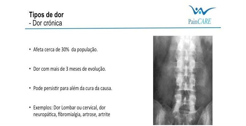 Dor Crónica