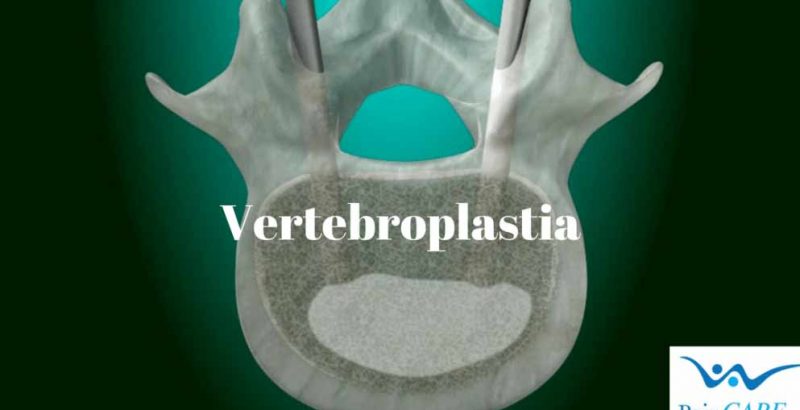 Vertebroplastia