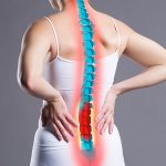 vertebroplastia