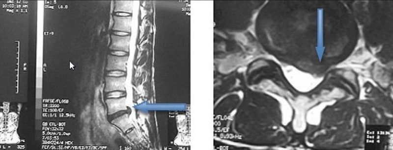 Dor Coluna Vertebral e os possíveis tratamentos