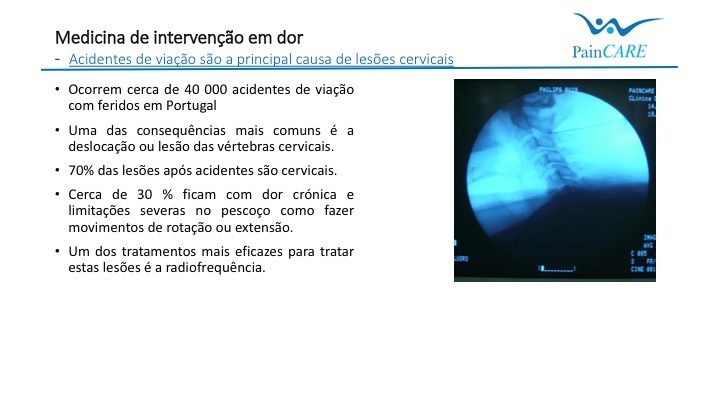 Lesões Cervicais: Os acidentes de viação são a principal causa